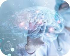 Alzheimer's Disease Micro-model