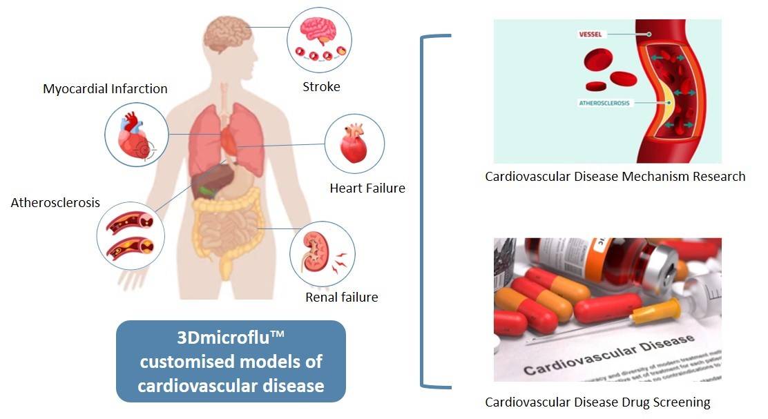 3Dmicroflu for in vitro cardiovascular disease modelling. - CD BioSciences.