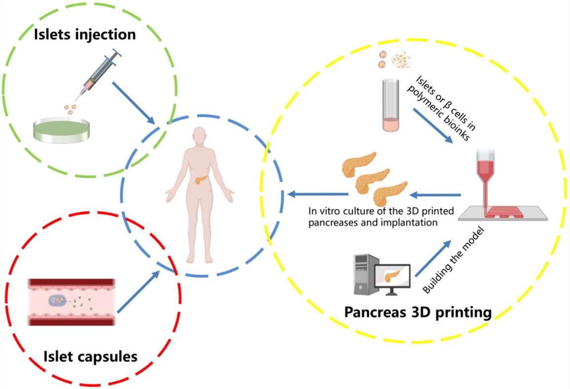 Figure 1. Diabetes treatment strategies.