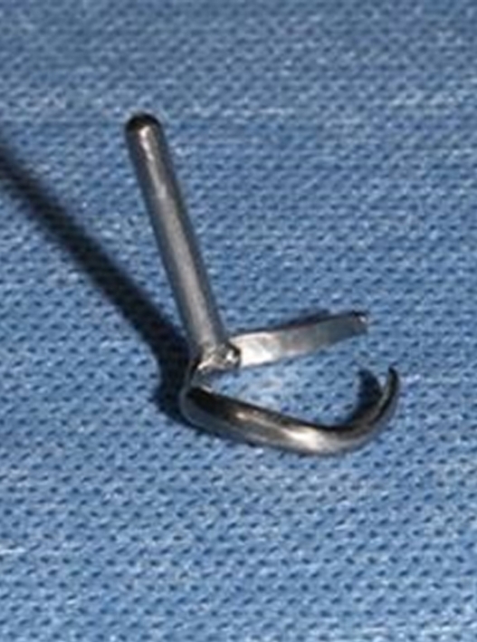 An arm clasp of metal removable partial denture with 3D printing processing technique.