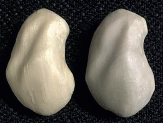 3D printed scaphoid prosthesis made of industrial-grade (light-colored) and medical-grade (dark-colored) PEEK. 