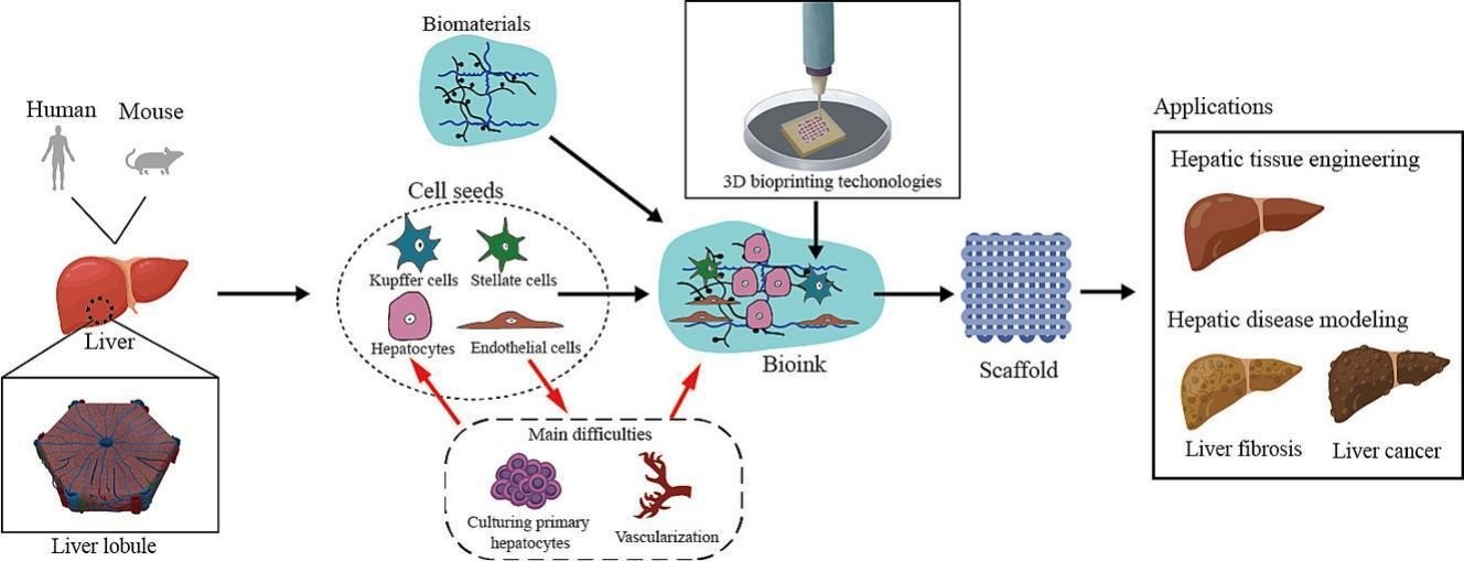 Figure 1. 3D bioprinted liver disease models.