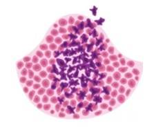 Tumour Metastasis Micro-model