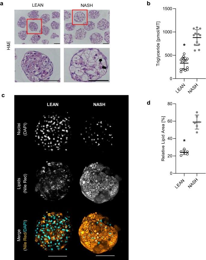 Figure 1. Steatosis-like phenotype and lipid accumulation in hLiMT treated for NASH. (Ströbel S, et al.; 2021)