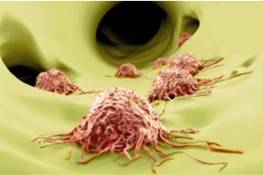 Tumour Metastasis Micro-model 3D Printing Service