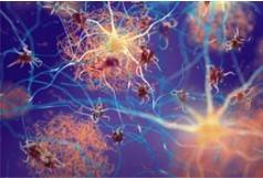 Alzheimer's Disease Micro-model 3D Printing Service