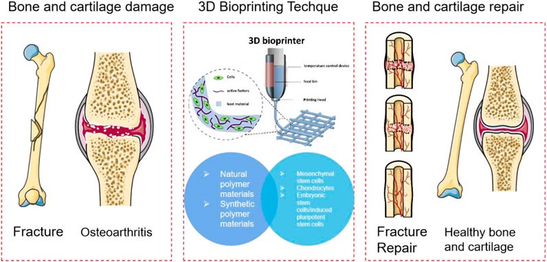 Figure 1. Schematic diagram of bone and cartilage using 3D bio printing based on polymer materials.