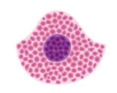 Solid Tumour Micro-model