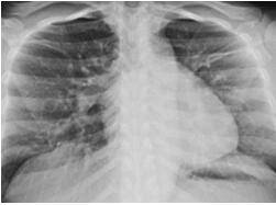 Disease Mechanism Research Based on 3Dmicroflu™
