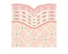 Skin Aging Micro-model