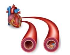 Complex Vascular Micro-model