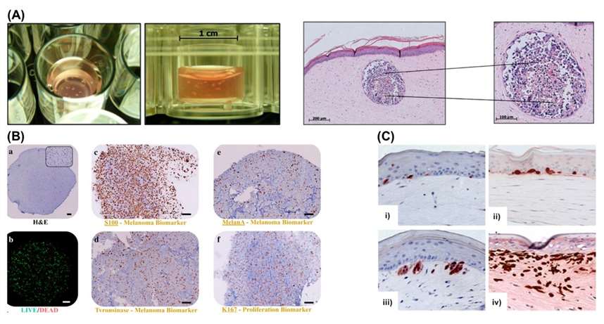 Figure 1. Melanoma models.