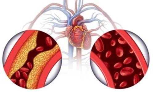 Cardiovascular Disease Mechanism Research Based on 3Dmicroflu