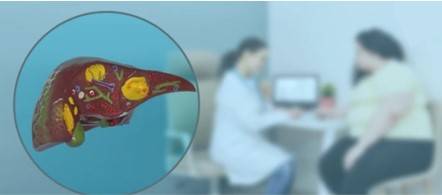 Metabolic Disease Mechanism Research Based on 3Dmicroflu™