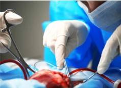 Organ Transplantation Feasibility Study Based on 3Dmicroflu™